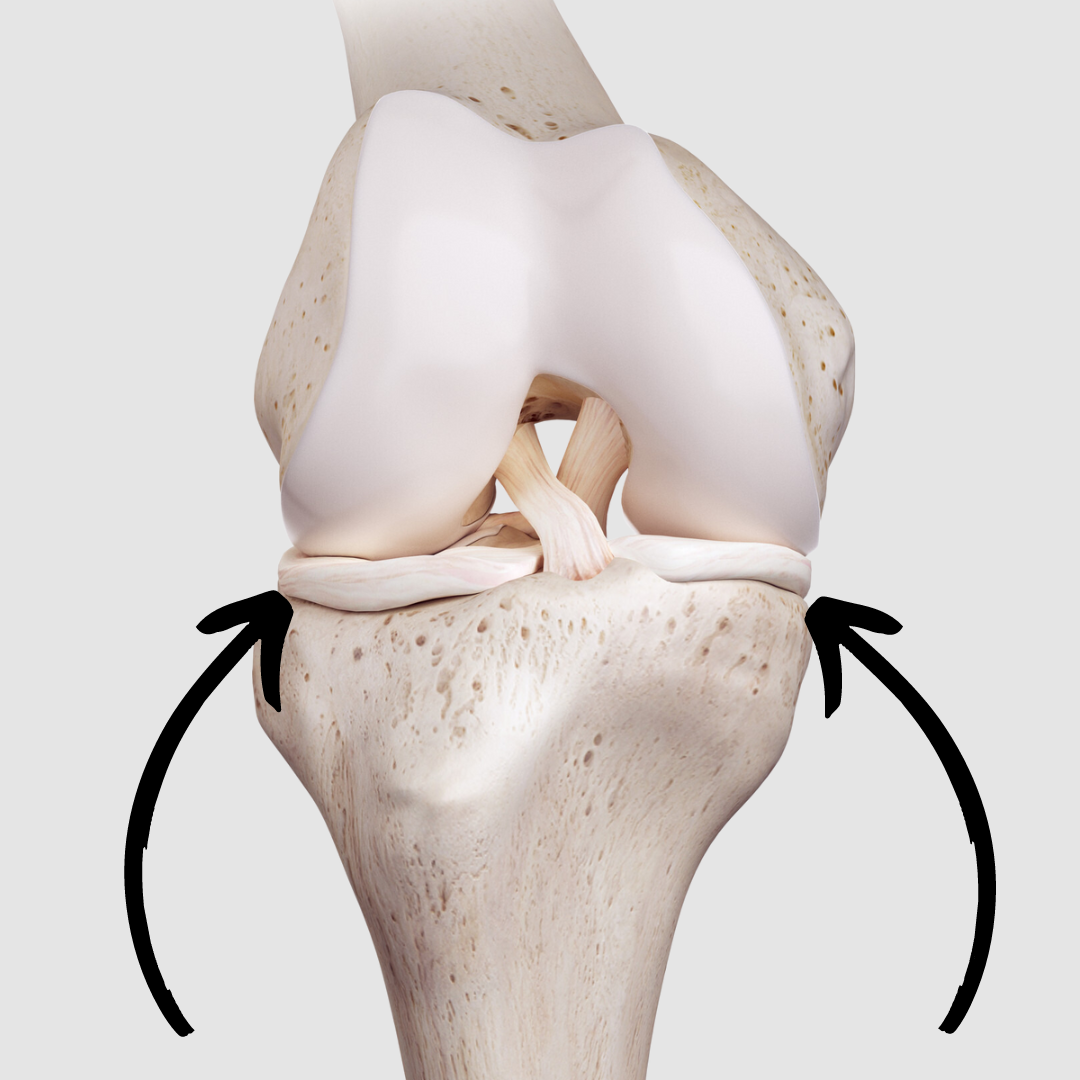 Knee Meniscus Injuries — Maximise Physiotherapy Clinic