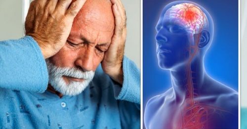 Stroke: 'Mood and fatigue-related symptoms' may precede a stroke by years | Express.co.uk